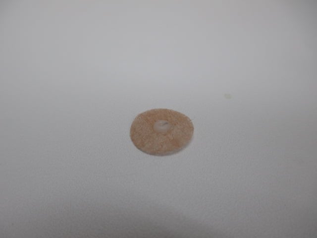 置き鍼
